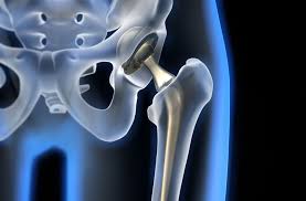 Arthrose, Schmerzen und Entzündungen